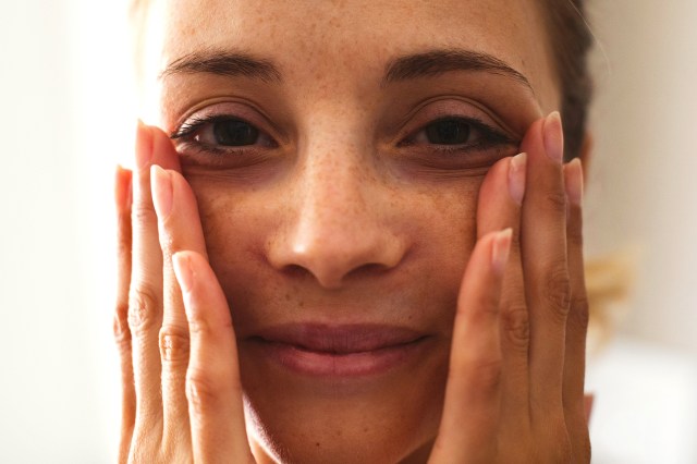 woman with freckles and dark circles putting her hands on her face 