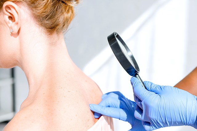 Woman getting her back examined by doctor with magnifying glass and gloves