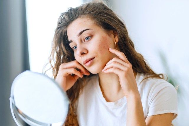 Young woman with problem skin looking into mirror