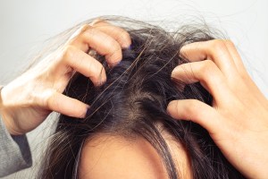 Woman itching scalp