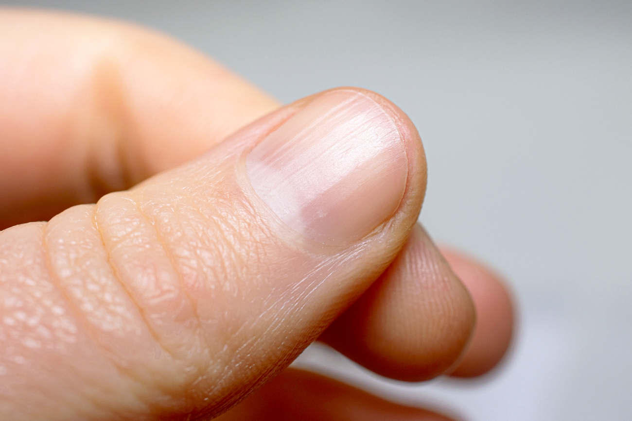 Fingernail with ridges